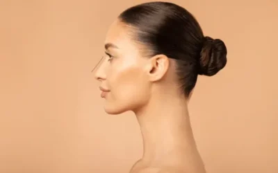 Cómo eliminar la papada: Soluciones armoniosas para tu bienestar facial